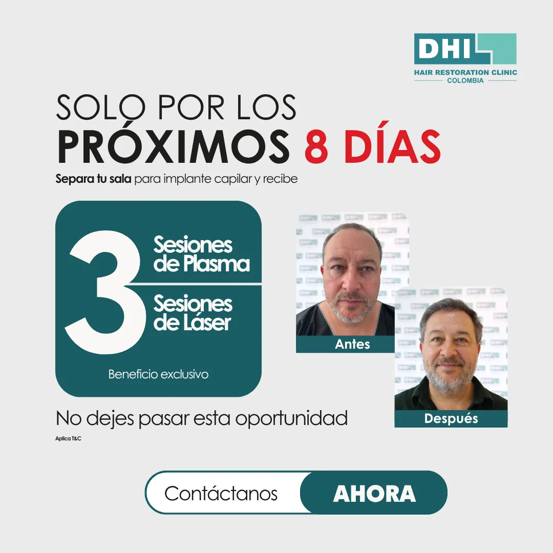 Promoción especial en implante capilar DHI